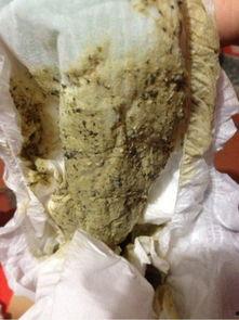 吃佛手瓜大便黑正常吗,正常现象解析